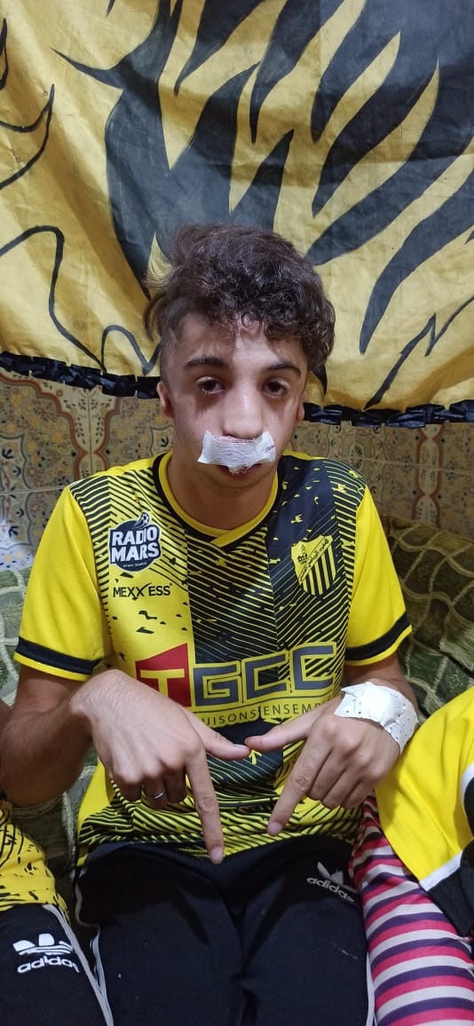 مزال ناس الخير.. محسن يتفاعل مع “لايف” خبايا نيوز ويجري عملية جراحية تجميلية للشاب يوسف “المصاوي”
