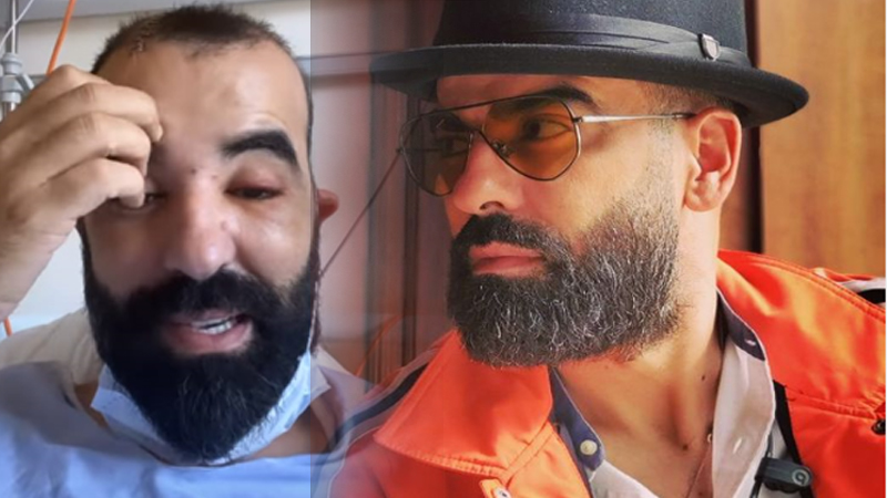 “كلشي على الله” .. عمل فني للحضري حول معاناته مع السرطان